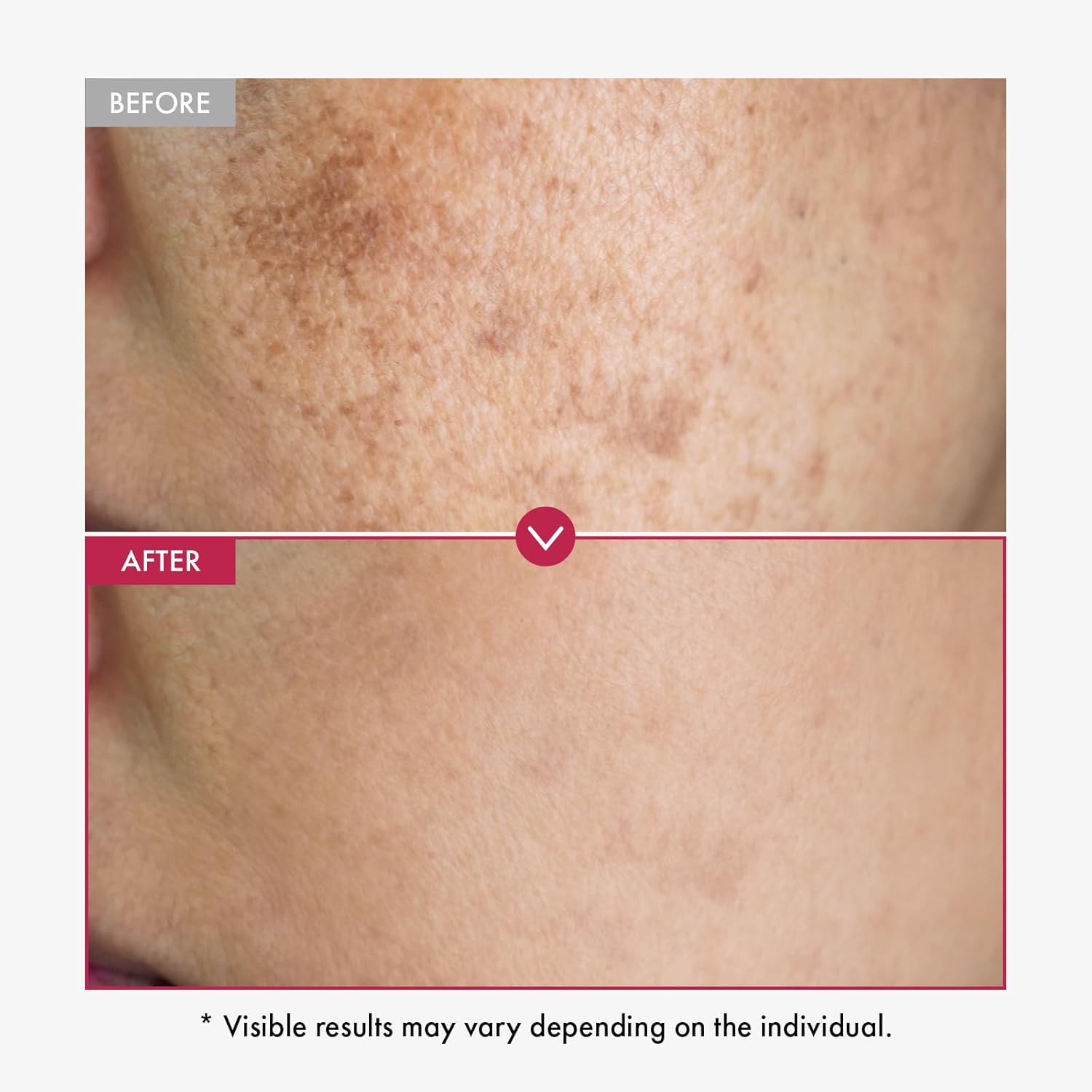 アルファ アルブチン セラム AHA 顔と体のセラムを滑らか - Alpha Arbutin Serum のレビューと価格